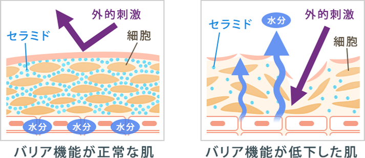 赤ら顔の治し方に悩む人のためのオールインワン化粧品ｕｌｕ ウルウ 赤ら顔対策には日本ドライスキン研究所